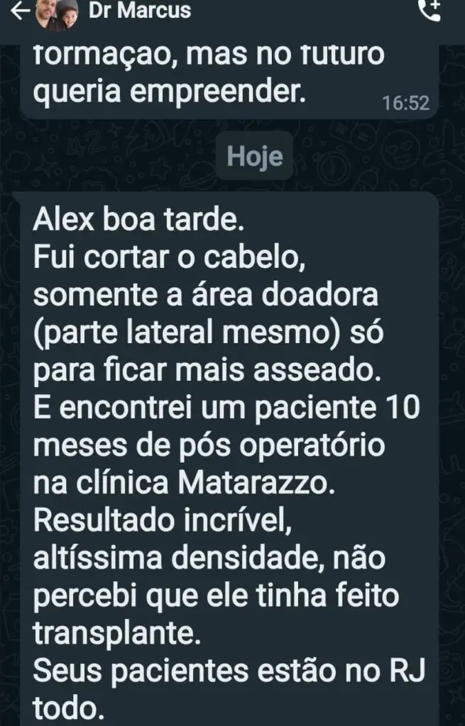 Relatos Sobre a Matarazzo Transplante Capilar