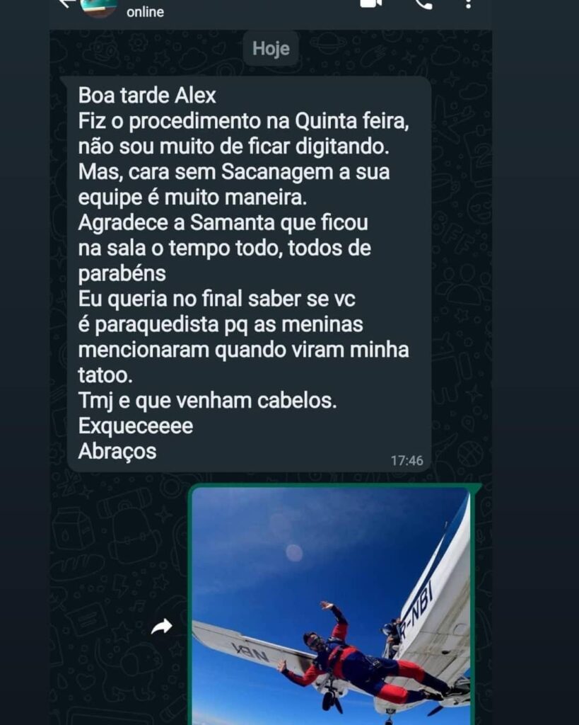 Transplante Capilar feito na Clinica Matarazzo