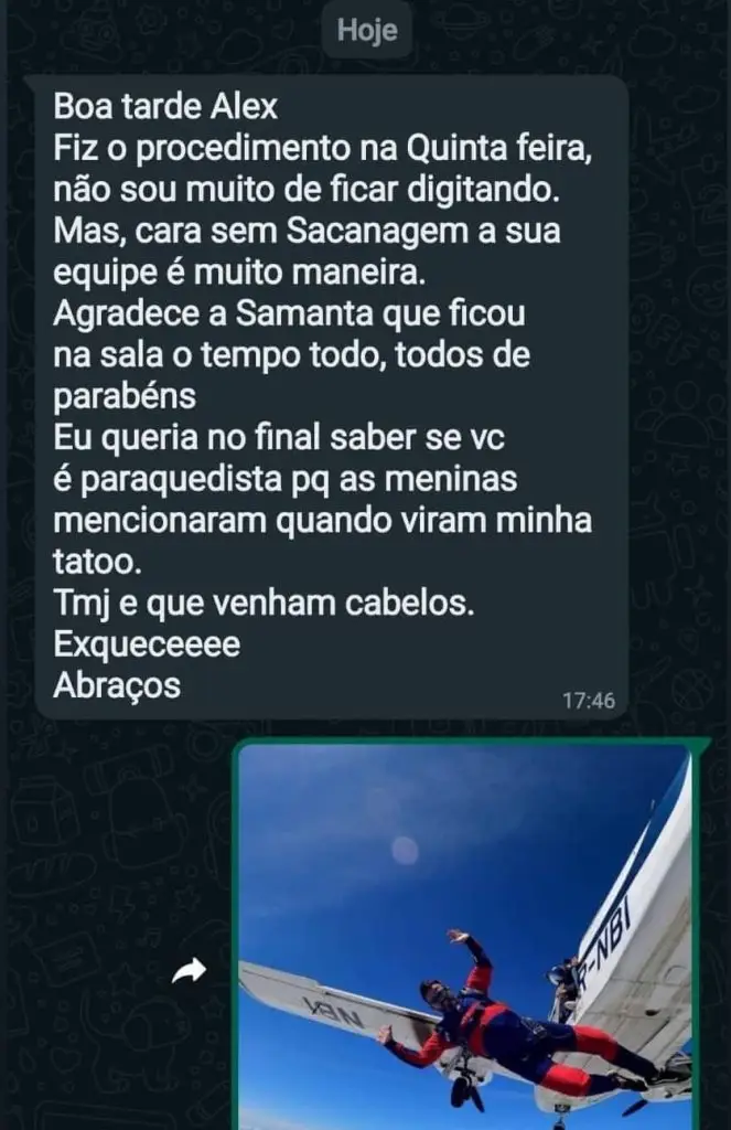 Transplante Capilar feito na Clinica Matarazzo
